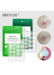 BREYLEE Acne Pimple Patch Stickers Acne Treatment Pimple Remover Tool Spot Blemish Face Mask Skin Care Waterproof 22 Patches