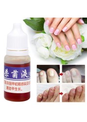 10mlFoot Fungal Care Nail Liquid Mycosis Whitening Toe Nail Fungus Removal Gel Anti Paronychia Onychomycosis Supplies