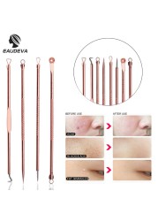 4pcs Stainless Steel Acne Removal Needles Pimple Blackhead Remover Tools Spatula Facial Skin Care Tools Needles Facial Pore Cleaner