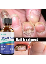 50ml Nail Repair Extract Anti Fungal Nail Treatment Remove Mycosis Nourishing Brighten Hand Foot Toes Nail Care