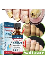 Fungal Nail Treatment Serum Onychomycosis Paronychia Anti-Fungal Nail Infection Herbal Toe Fungus Foot Repair Essence Care 50ml