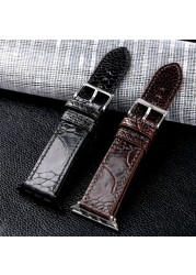 South African Ostrich Foot Leather Watchband Suitable For iwatch 44 42 40 4145mm Apple Watch Bracelet Handmade Genuine Leather