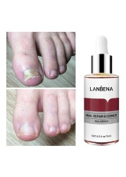 Nail Fungal Treatment Essence Foot Toe Nail Fungus Removal Gel Anti Infection Paronychia Nails Nail Repair