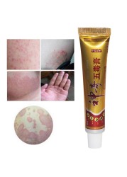 YIGANERJING Useful Psoriasis Cream Psoriasis Ointment Eczematoid Dermatitis Ointment Moisturizing Skin Cream