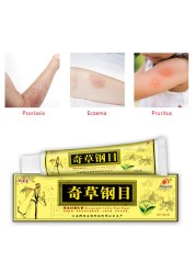 Bian Chicao Bing Skin Psoriasis Cream 999 Ointment of Psoriasis Psoriasis Treatment Relief Various Skin Problem