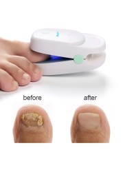 Nail Cleaning Infrared LED Light Therapy For Nail Fungus Cold Laser Physiotherapy