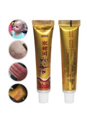 YIGANERJING Useful Psoriasis Cream (without retail box)