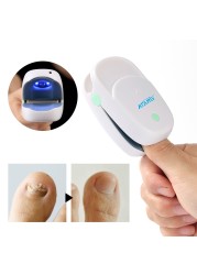 Fungal Nail Treatment Ingrown Toenails Treatment Anti-infection Paronychia Onychomycosis Treatment Infrared Light Therapy