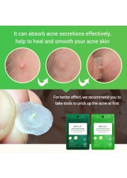 BREYLEE Acne Pimple Patch Stickers Acne Treatment Pimple Remover Tool Spot Blemish Face Mask Skin Care Waterproof 22 Patches