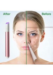 Laser Pen Blue Light Therapy Pigment Tattoo Scar Mole Freckle Removal Machine Scar Wrinkle Removal Device For Women