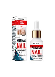 50ml Nail Repair Extract Anti Fungal Nail Treatment Remove Mycosis Nourishing Brighten Hand Foot Toes Nail Care