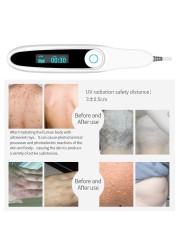 Yongrow UVB Phototherapy Instrument Vitiligo Treatment Lamp UV Treatment Psoriasis Laser Lamp Vitiligo Phototherapy