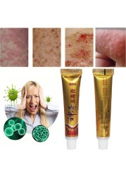 YIGANERJING Useful Psoriasis Cream Psoriasis Ointment Eczematoid Dermatitis Ointment Moisturizing Skin Cream