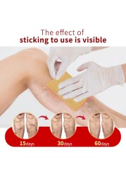 6pcs Varicose Veins Treatment Chinese Herbal Medicine Removal Phlebitis Vasculitis Spider Leg Veins Pain Plaster