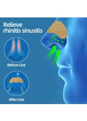 6/12/18/24pcs Rhinitis Allergy Reliever Patch Sinusitis Medical Treatment Nasal Strips Nasal Congestion Sneezing Cure