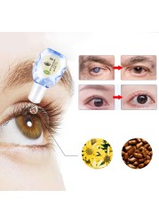 12ml Cool Eyes Drops Cataract Eye Treatment Cleanse Toxins Remove Eyeball Fatigue Relieves Discomfort Eye Health Care Drops