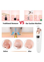 Blackhead Suction Blackhead Remover Black Skin Suction Blackhead Remover Facial Pore Cleaner Dropship Skin Peeling Beauty Device