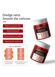 AUQUEST Varicose Veins Treatment Cream Relieve Fatigue Legs Dilatation Inflammation Felipe Vasculitis Spider Pain Relief Ointment Body Care 80g