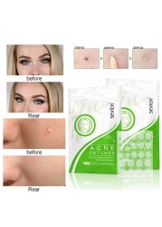 36pcs Hydrocolloid Acne Cosmetics Patch Set Acne Tag Remover Pimple Master Hydrocolloid Patch Face Skin Care TSLM1