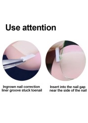 10pcs/set Ingrown Toenail Correction Tool Pain Care Ingrowing Nail Corrector Used For Home