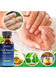 Nail Repair Serum Nail Fungal Treatment Serum Toenail Fungus Treatment Device Antifungal Toe Fungus Treatment Foot Repair Care