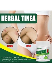 Effective Herbal Tinea Cream Fungal Anti Inflammation Ointment Infections Treatment Medicine Cream Health Care Tool