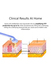 DARSONVAL جهاز ماكينة تجميل الوجه عالية التردد للشعر الوجه مكافحة الشيخوخة العلاج حب الشباب أداة الانصهار النيون الأرجون الصولجانات الجلد الجمال