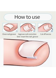 أداة تصحيح أظافر القدم الداخلية ، أداة تجديف للأظافر تستخدم في المنزل ، 10 قطعة/المجموعة/مجموعة