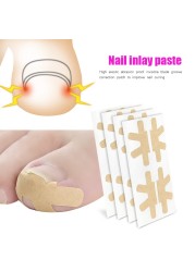 Professional Paronychia Treatment Sticker Ingrown Toenail Nail Corrector Ingrown Feet Care Tools Pedicure Toenail Care