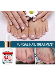 50ml Nail Repair Extract Anti Fungal Nail Treatment Remove Mycosis Nourishing Brighten Hand Foot Toes Nail Care