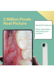 Endoscope Camera HD 1080P Waterproof Dental Intraoral Camera Mini Wifi Endoscope Oral Inspection Camera for iPhone iPad Andorid