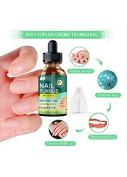 Nail Fungus Treatment Feet Care Nail Essence Repair Foot Toe Nail Fungus Removal Gel Anti Infection Paronychia Onychomycosis