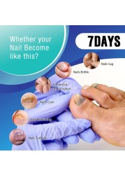 Nail Repair Serum Nail Fungal Treatment Serum Toenail Fungus Treatment Device Antifungal Toe Fungus Treatment Foot Repair Care