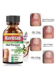 Fungal Nail Treatment Essential Oil Whitening Hand And Foot Toe Nail Fungus Remove Infection Feet Care Polish Nail Gel 50ml