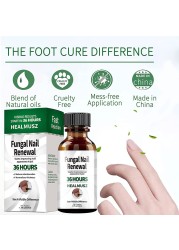 Fungal Nail Treatment Serum Onychomycosis Paronychia Anti-Fungal Nail Infection Herbal Toe Fungus Foot Repair Essence Care 50ml