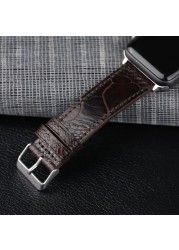 South African Ostrich Foot Leather Watchband Suitable For iwatch 44 42 40 4145mm Apple Watch Bracelet Handmade Genuine Leather