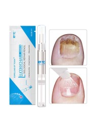 3ml Effective Nail Fungus Pen For Paronychia Infection Treatment Solution Gel Nail Treatment Essence Nutrients