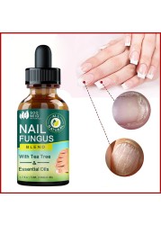 Nail Fungus Treatment Feet Care Nail Essence Repair Foot Toe Nail Fungus Removal Gel Anti Infection Paronychia Onychomycosis