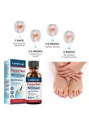 Fungal Nail Treatment Serum Onychomycosis Paronychia Anti-Fungal Nail Infection Herbal Toe Fungus Foot Repair Essence Care 50ml