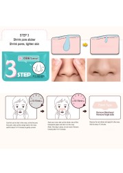 Remove Blackhead Nose Patch 3 Steps T Area Care Deep Clean Pores Blackhead Clean Face Care Products Shrink Pore Sticker