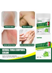 Effective Herbal Tinea Cream Fungal Anti Inflammation Ointment Infections Treatment Medicine Cream Health Care Tool