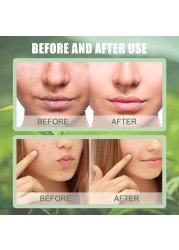 1pc Green Tea Mask Stick Purifying Mud Stick Facial Mask Cleansing Mask Oil-control Deep Clean Pores Skin Care 40g