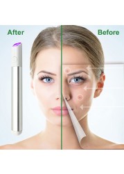 Laser Pen Blue Light Therapy Pigment Tattoo Scar Mole Freckle Removal Machine Scar Wrinkle Removal Device For Women