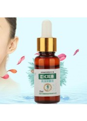 20ml Ear Acute Otitis Drops For Ear Ear Inflammation Deaf Health Care Chinese Herbal Medicine Ear Liquid