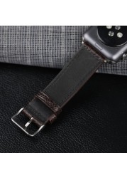 South African Ostrich Foot Leather Watchband Suitable For iwatch 44 42 40 4145mm Apple Watch Bracelet Handmade Genuine Leather