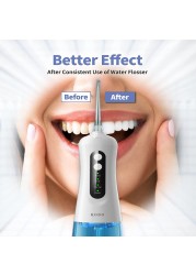 KUDO Oral Irrigator Dental Water Flosser USB Rechargeable Portable Dental Water Jet 300ml Dental Irrigator Floss